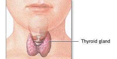 Hyperthyroidism from Wikipedia