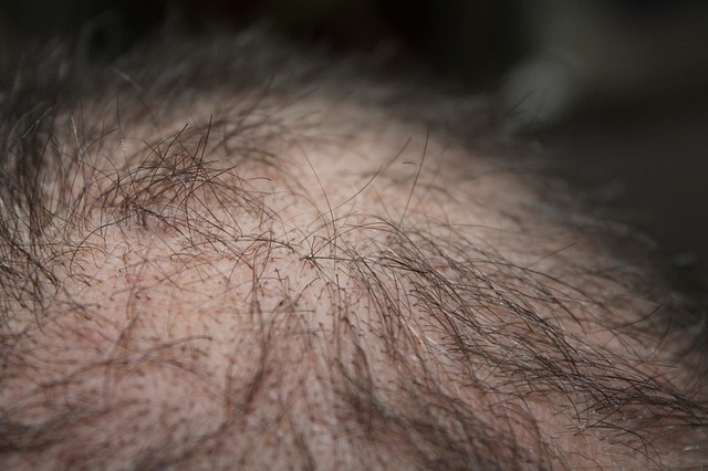 Factors That Could Lead to Hair Loss